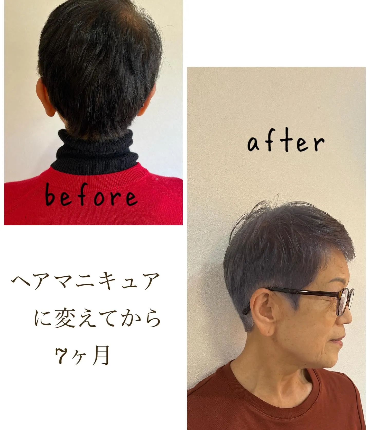 いままでヘアカラーでの頭皮トラブルに悩ませられながら我慢して...